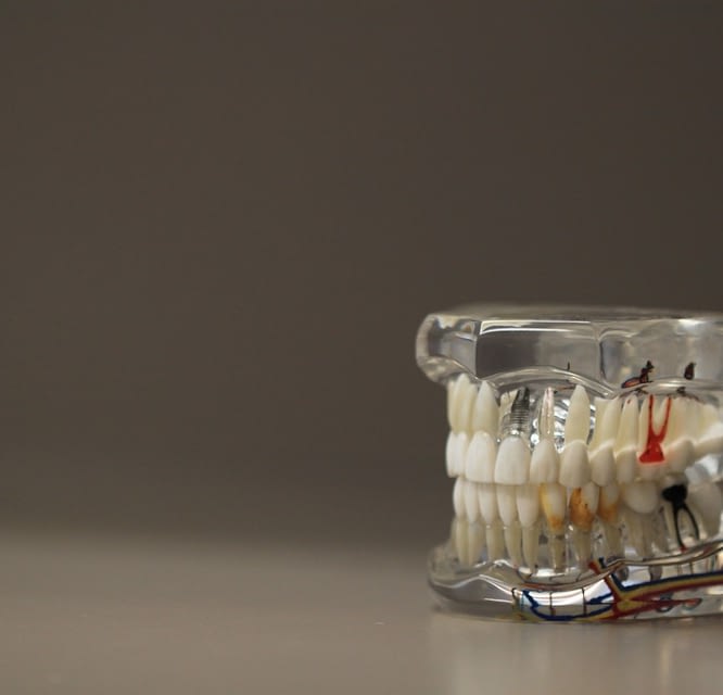 replica of gums