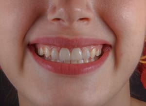 tooth