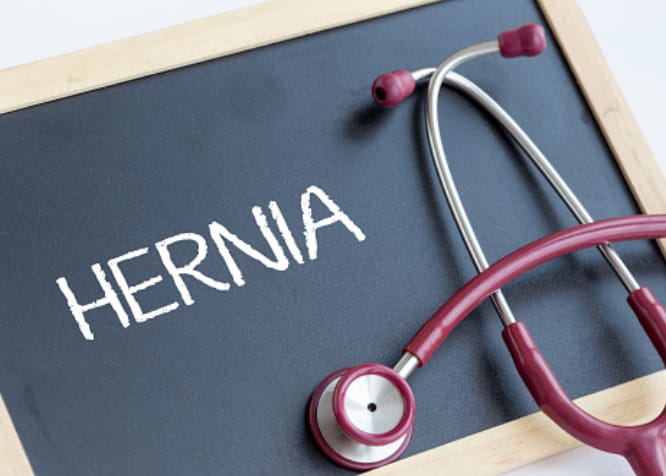 hernia disease